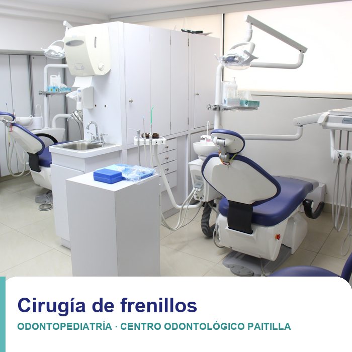 Cirugía de frenillos en niños