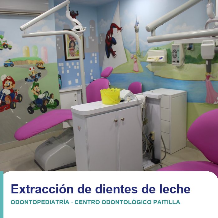 Extracción de dientes de leche en niños