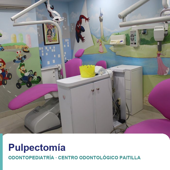 Pulpectomía en niños