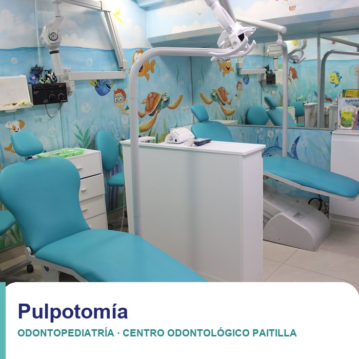 Pulpotomía en niños